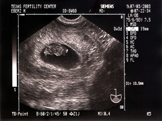 Mojo's Fetus 3